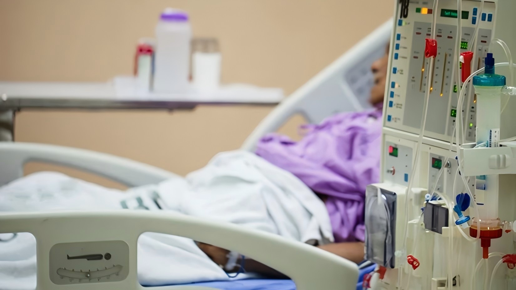 Dialysis Treatment Costs