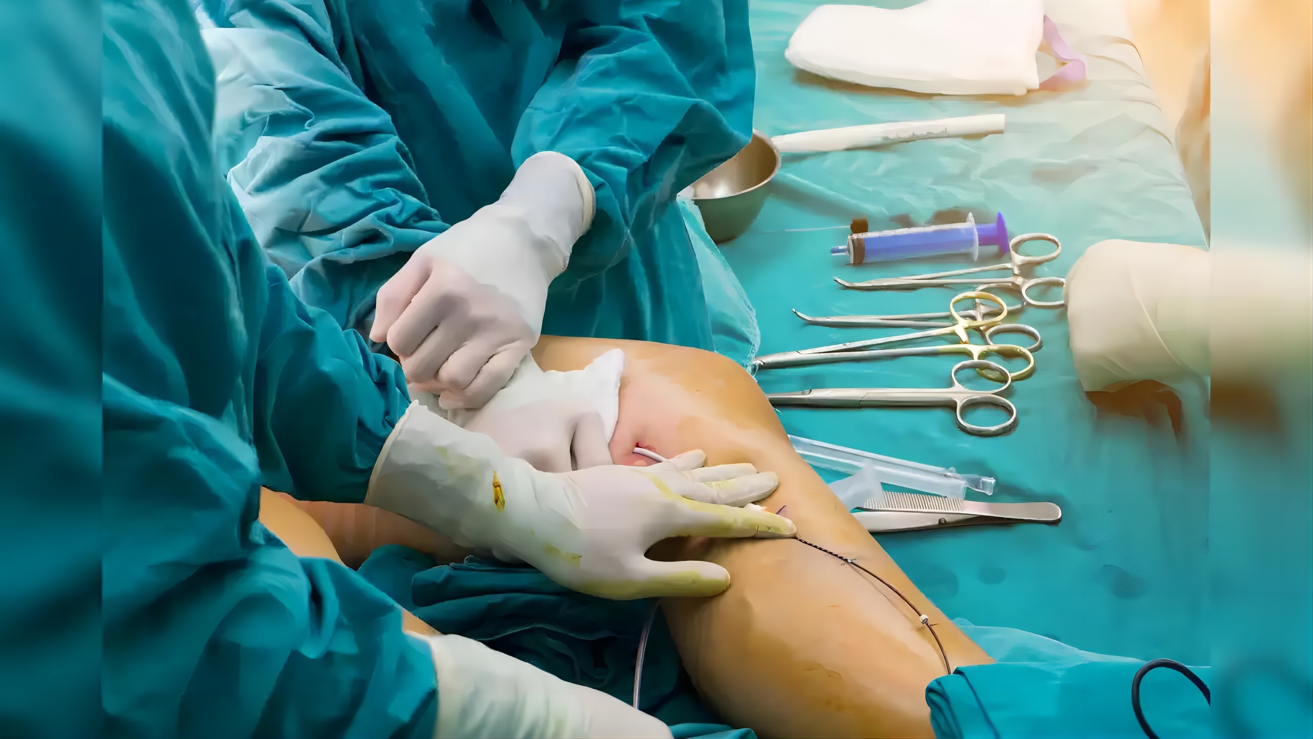 Electric Intraosseous Infusion System