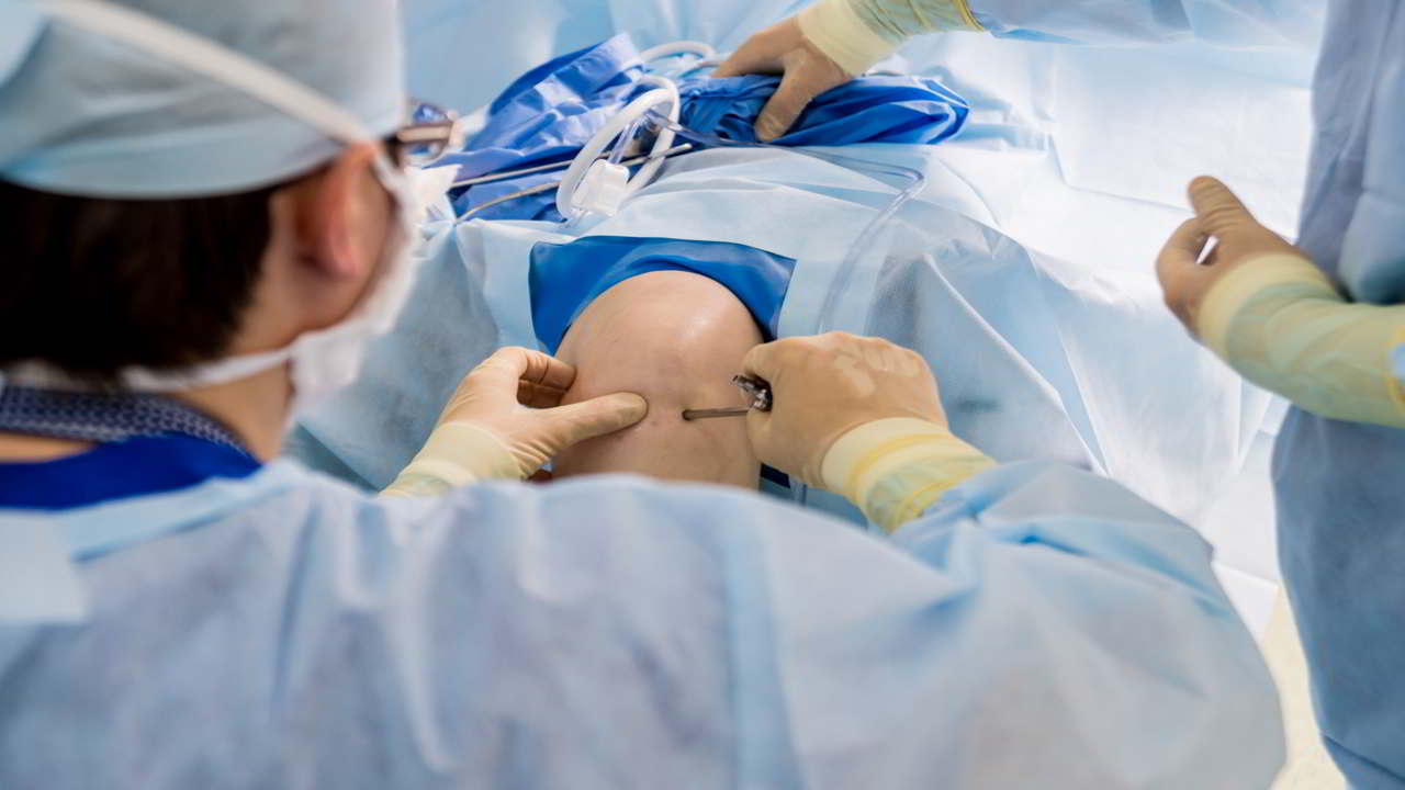 Disposable arthroscopy pack