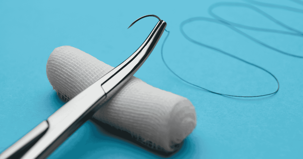 absorbable vs non absorbable suture1.png