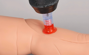 intraosseous access in pediatric(1).jpg