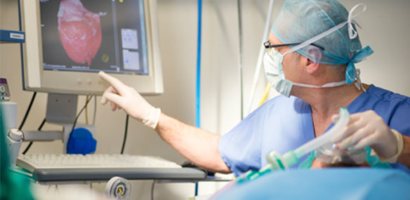 Cardiovascular Interventional Surgery