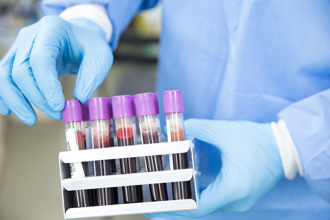 Disposable Vacuum Blood Collection Tube
