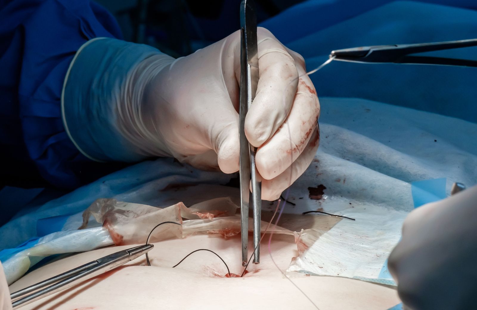absorbable vs non absorbable suture2.jpg