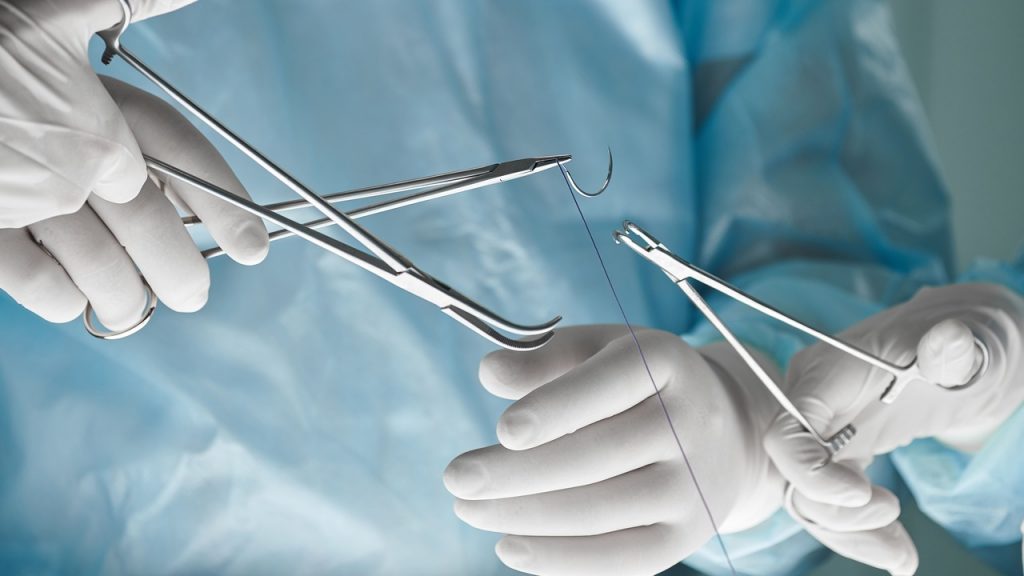 vicryl sutures2.jpg