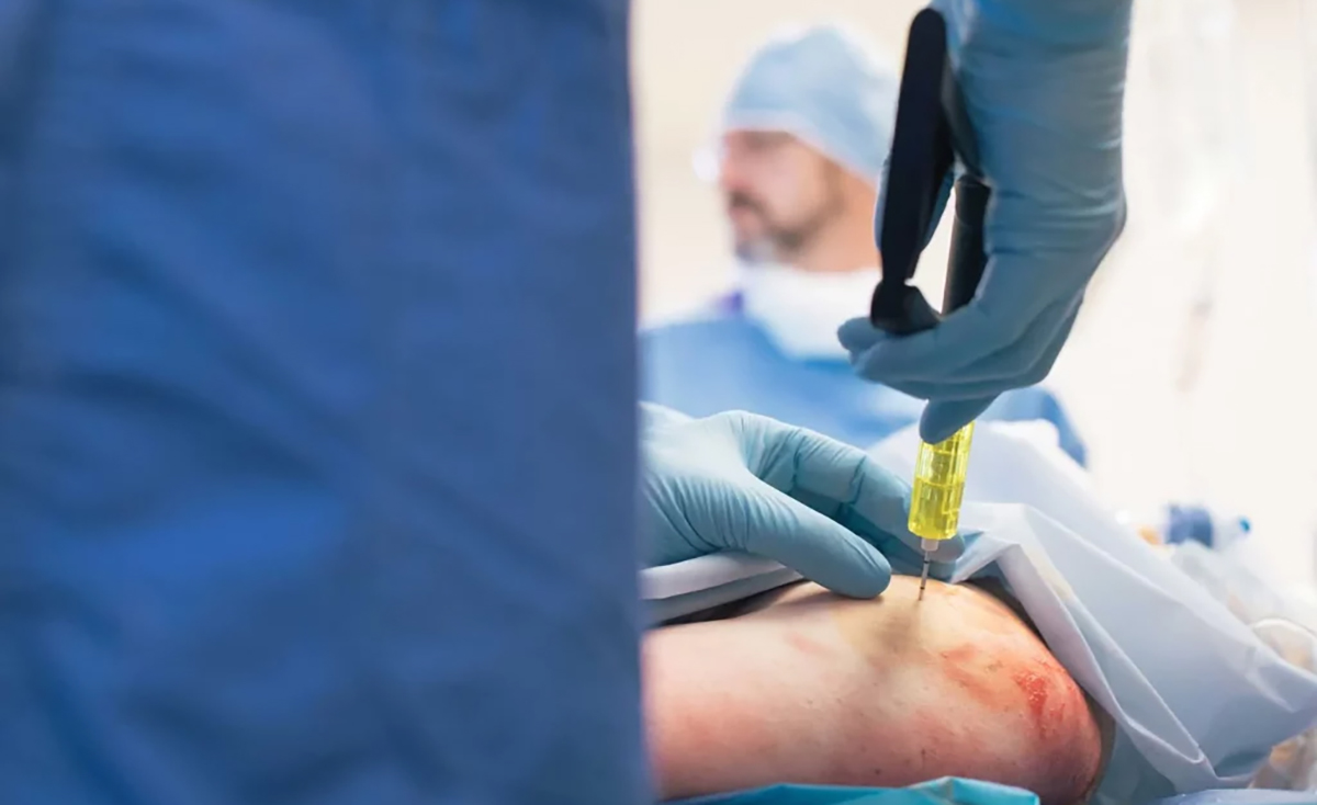 Intraosseous Access Complications3