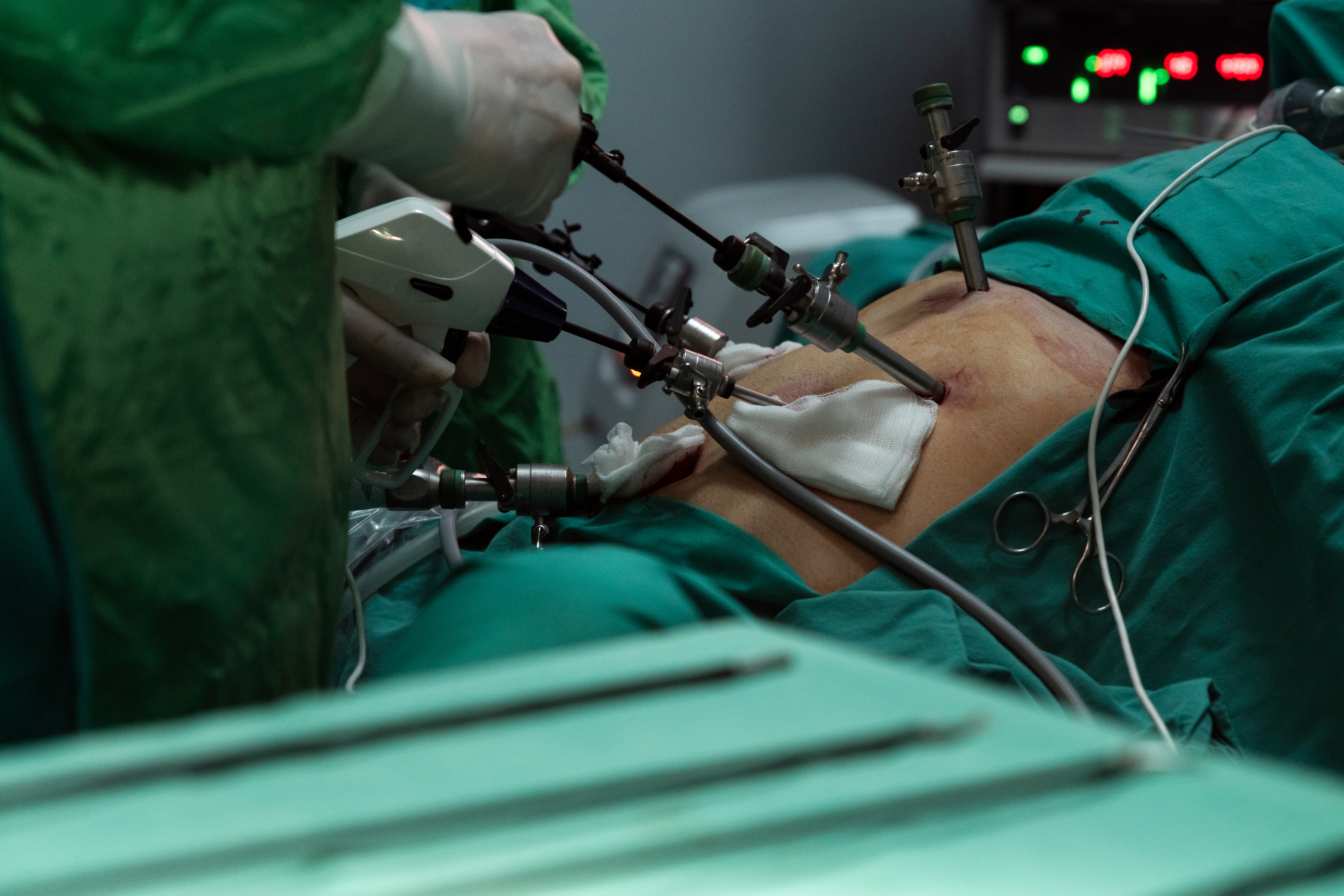 Laparoscopy Pelviscopy Pack