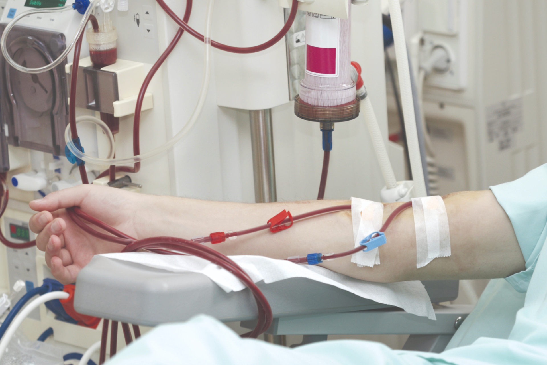 Blood Purification consumables