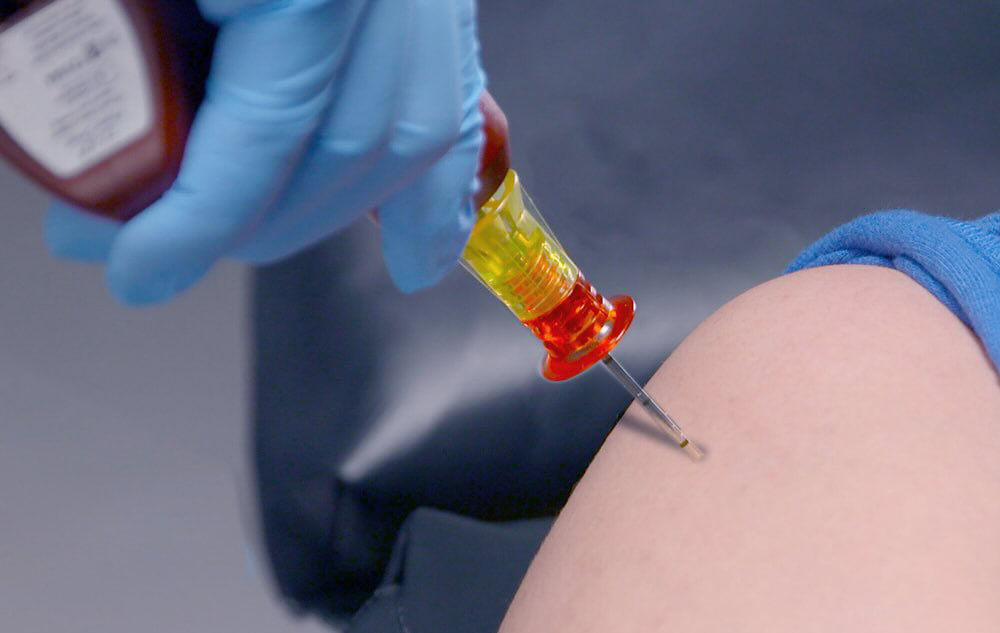 intraosseous infusion3