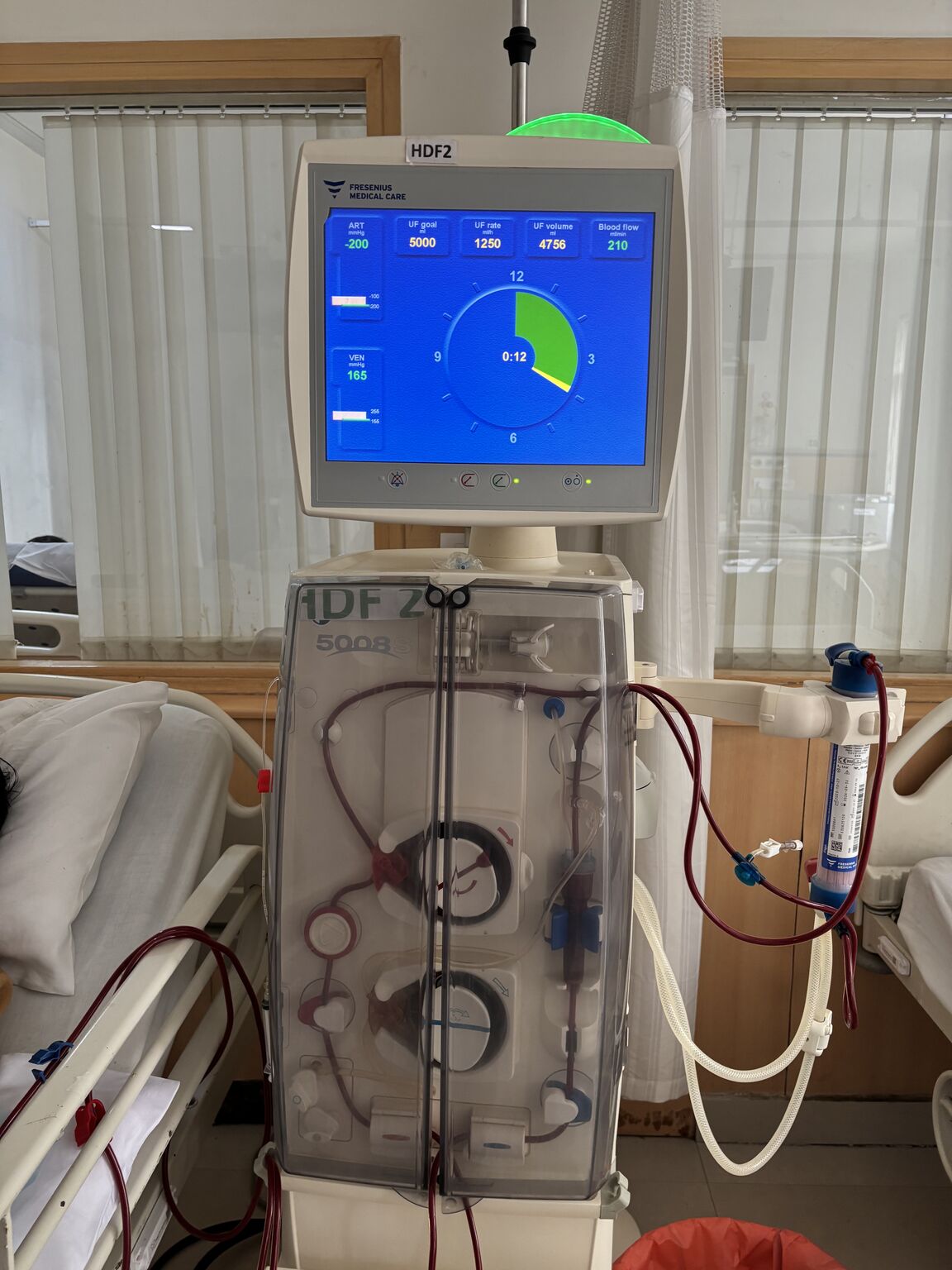 Fresenius 5008 Dialysis Machine Dedicated Bloodlines