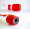 Disposable 2-10ml Pet Vacuum Blood Collection Red Clot Activator Tube