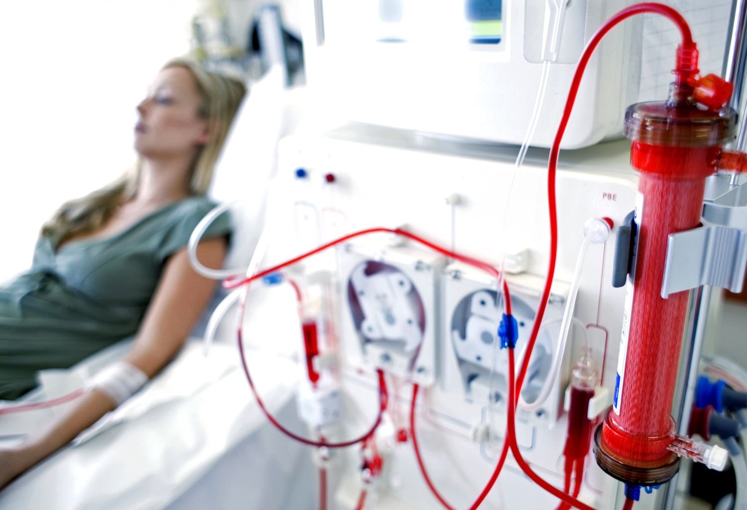 RENAL_DIALYSIS-56a275235f9b58b7d0cac1e2