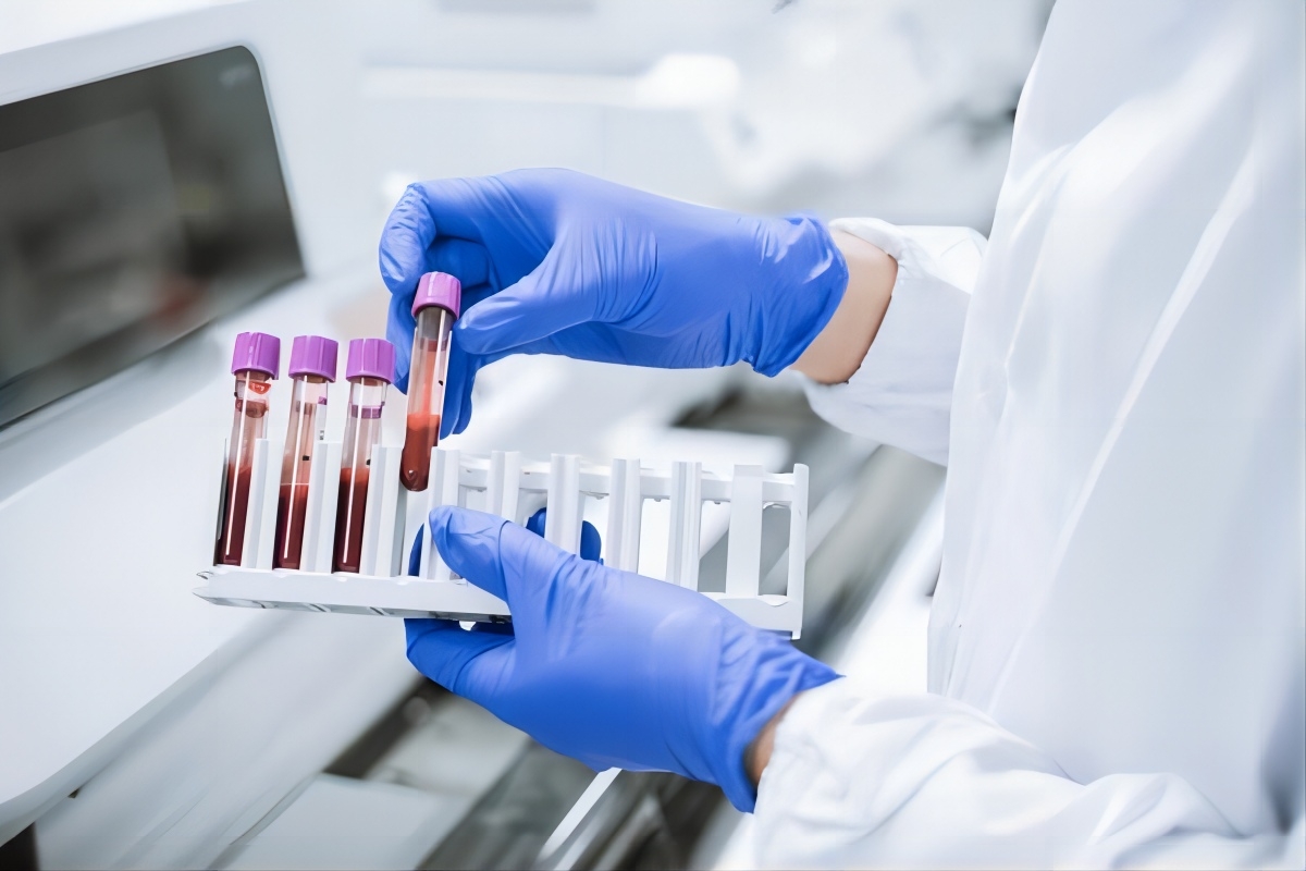 Disposable Vacuum Blood Collection Tube
