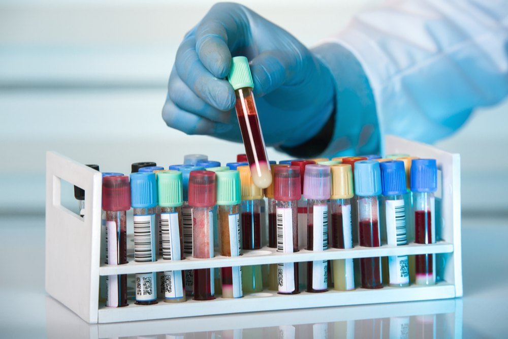 Disposable Vacuum Blood Collection Tube