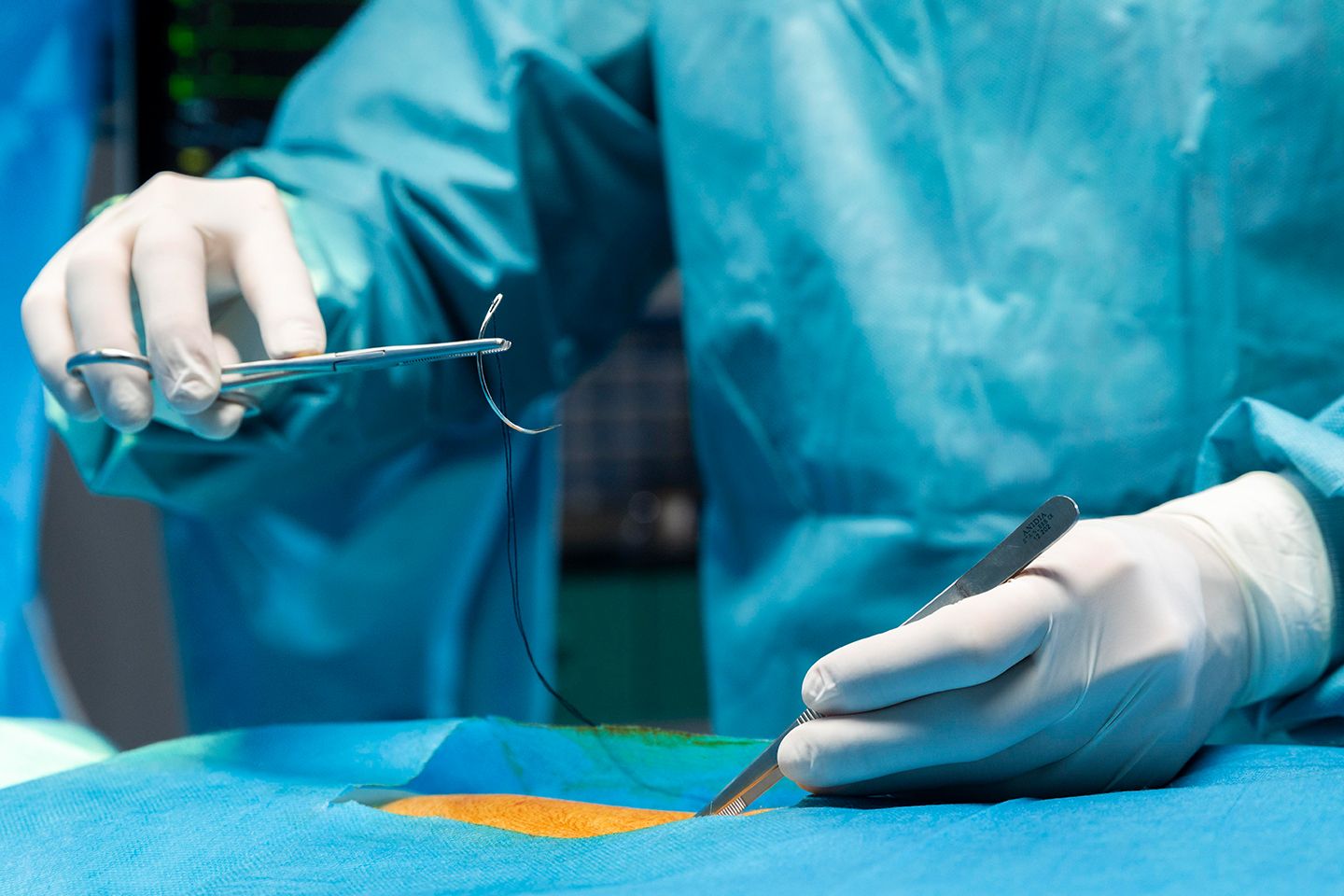 surgical site infection1.jpg