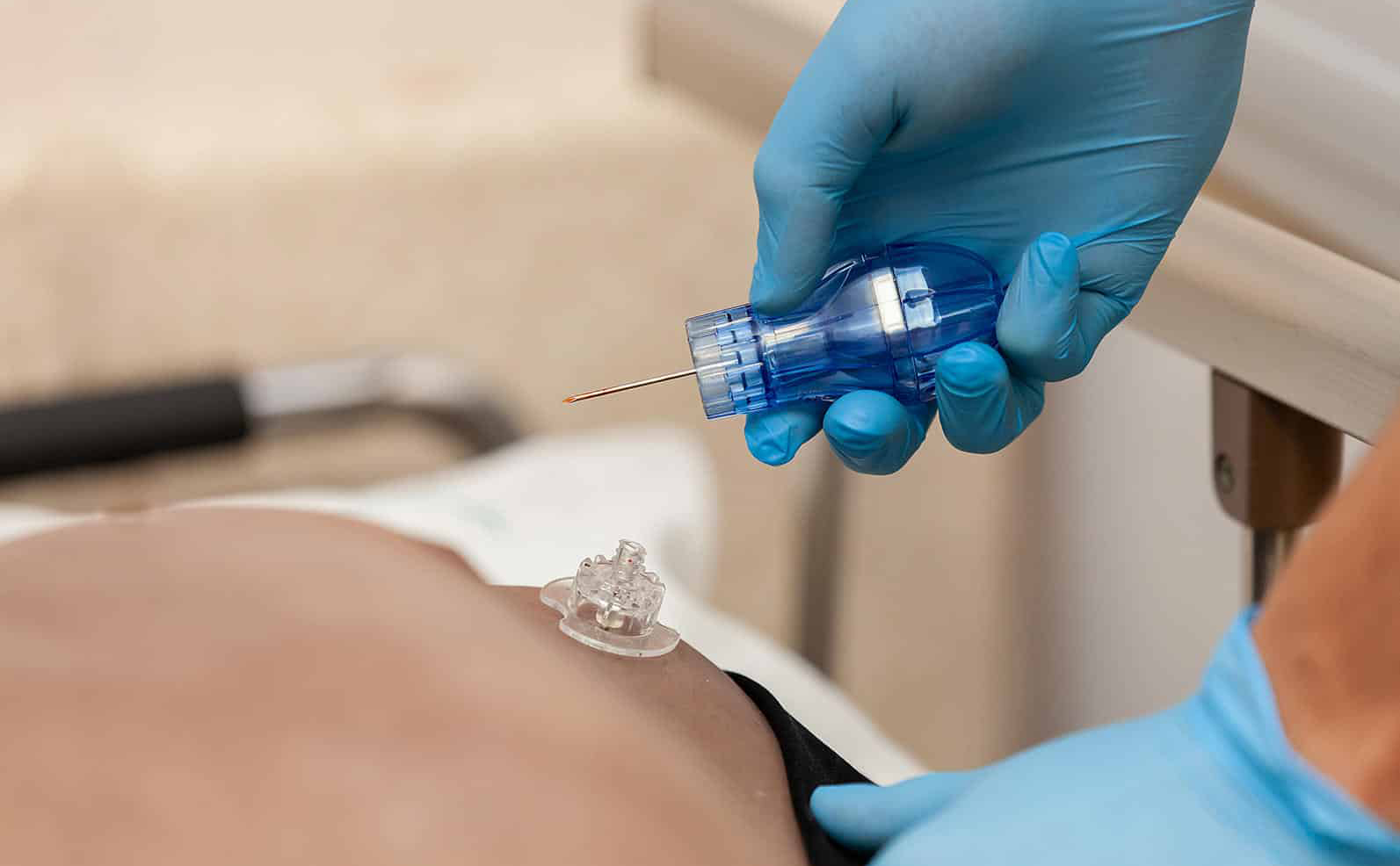 Intraosseous Access Complications1