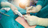Medical Surgical Instrument Disposable Skin Stapler for Wound Suture