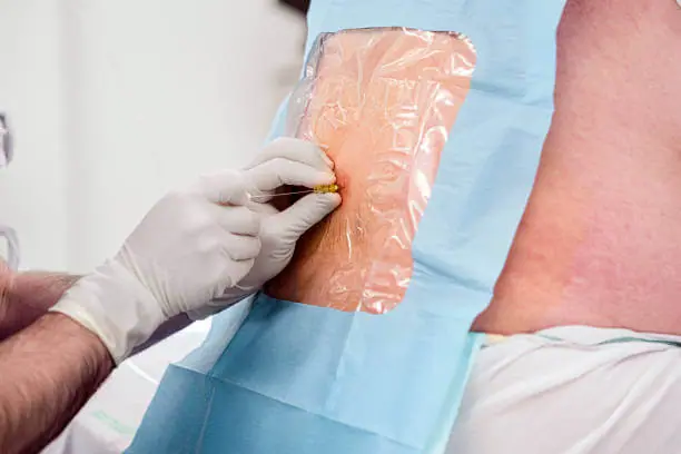Spinal Anesthesia Puncture Kit