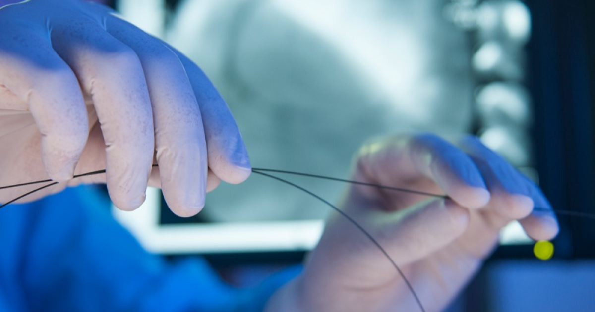Cardiovascular Interventional Surgery