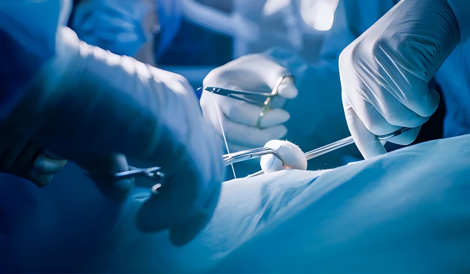 close-up-on-hands-of-the-professional-surgeon-suture-wound-after-successful-surgery