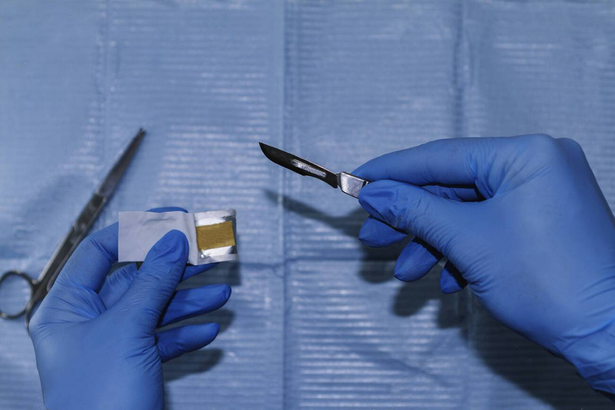 scalpel blade sizes1.jpg