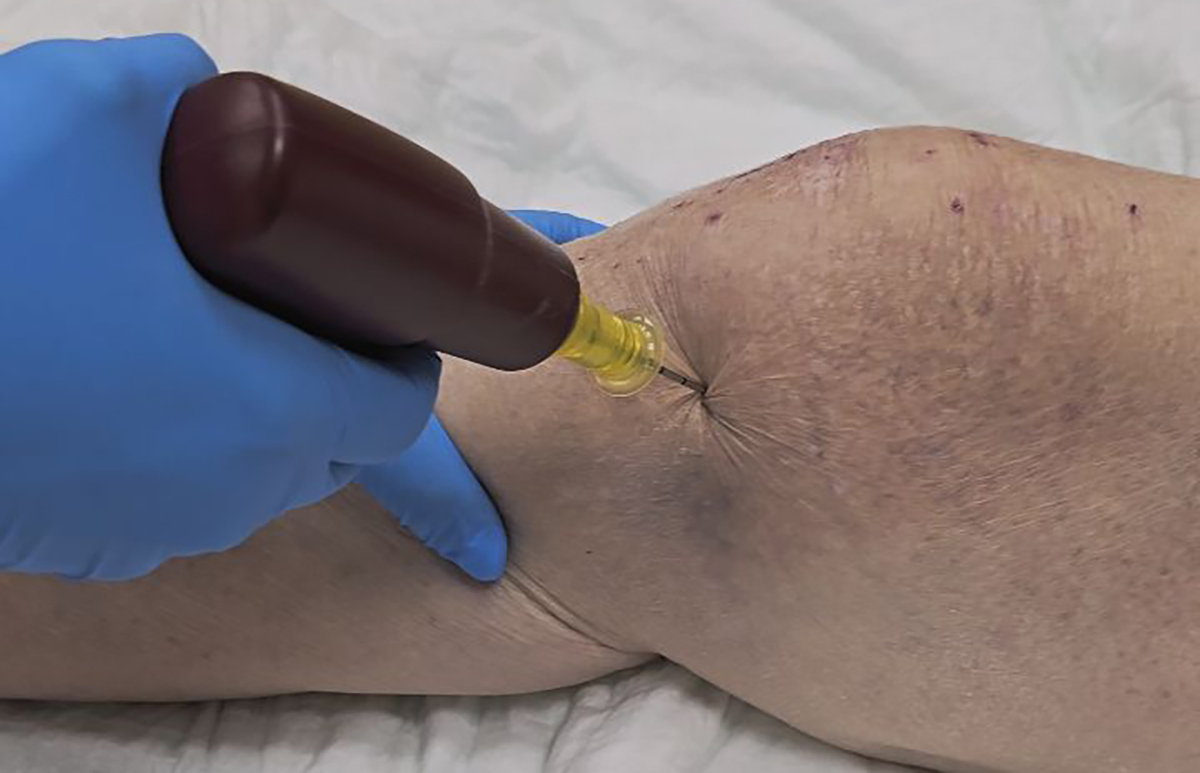 intraosseous infusion2.jpg