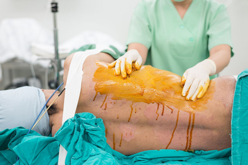 Spinal Anesthesia Puncture Kit
