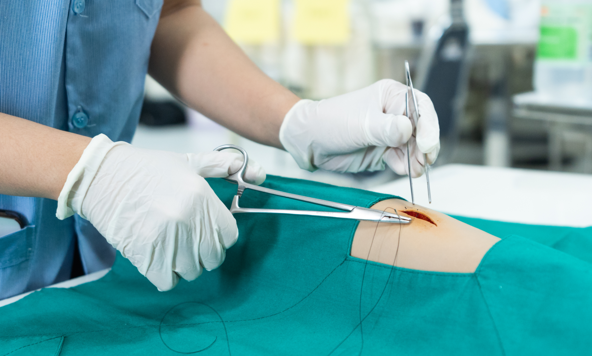 suture reaction1.png