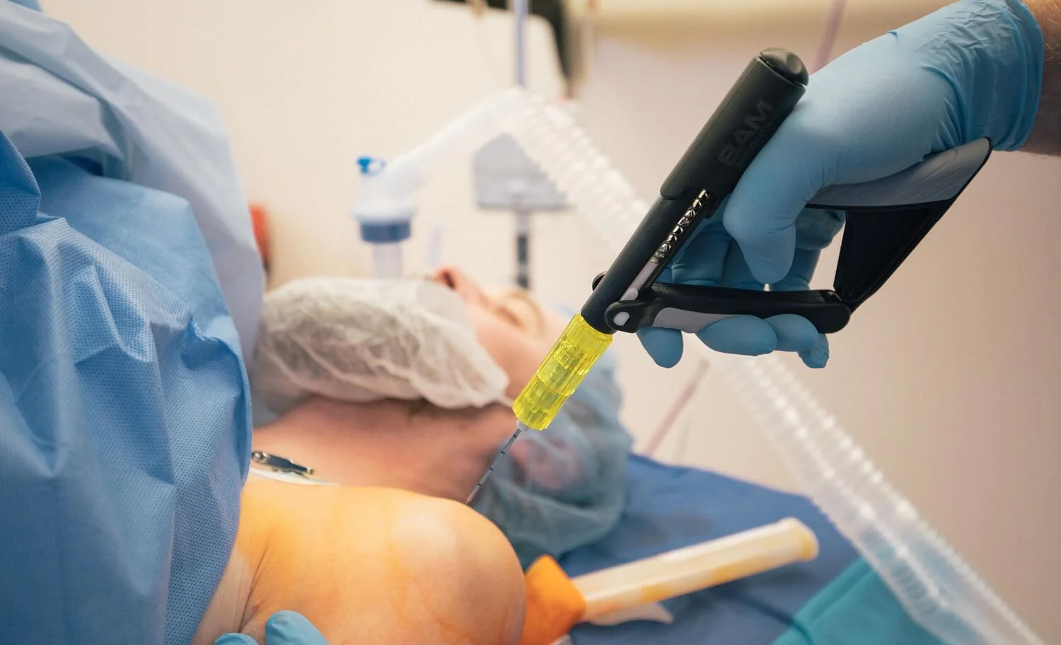 intraosseous access1.jpg