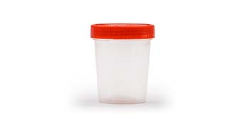 Urine cup.jpg