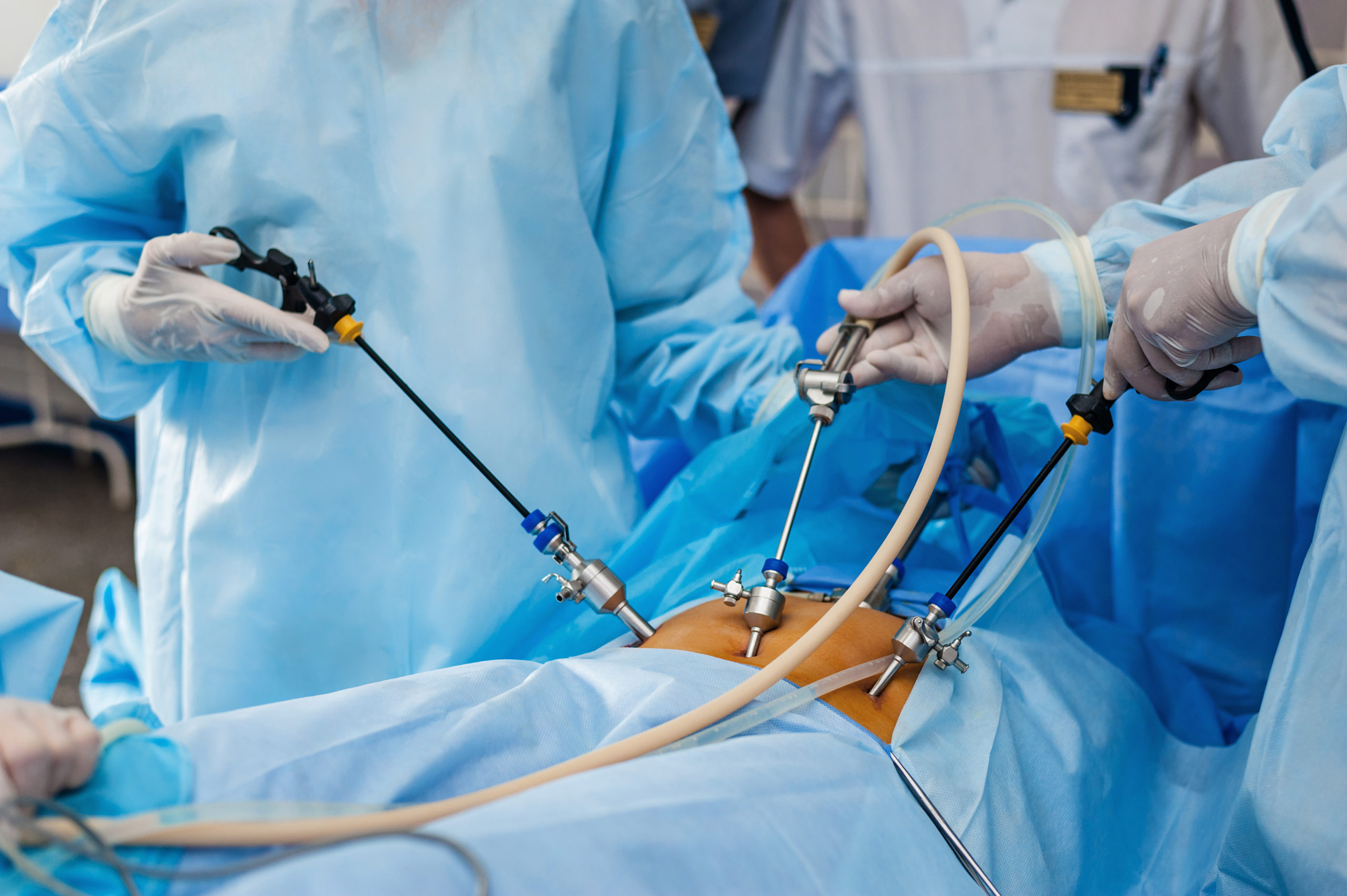 Laparoscopy Pelviscopy Pack