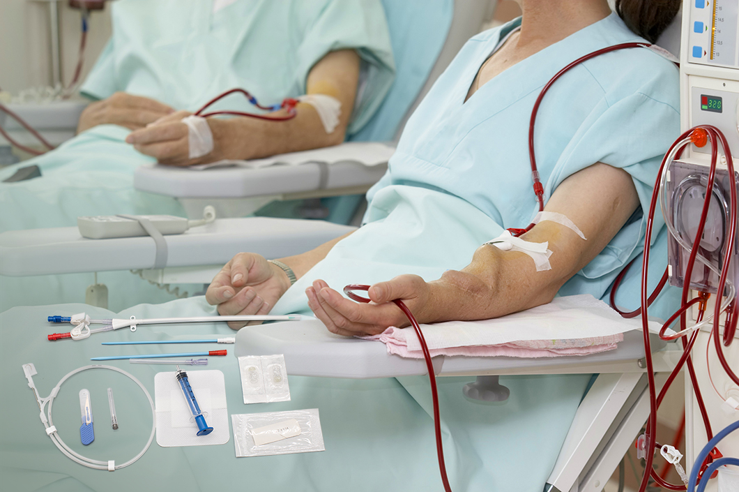 dialysis catheter