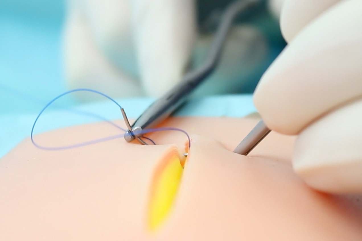 surgical site infection4.jpg