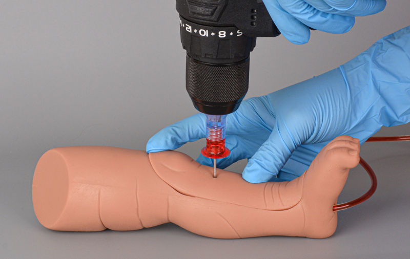 intraosseous access in pediatric 1.jpg