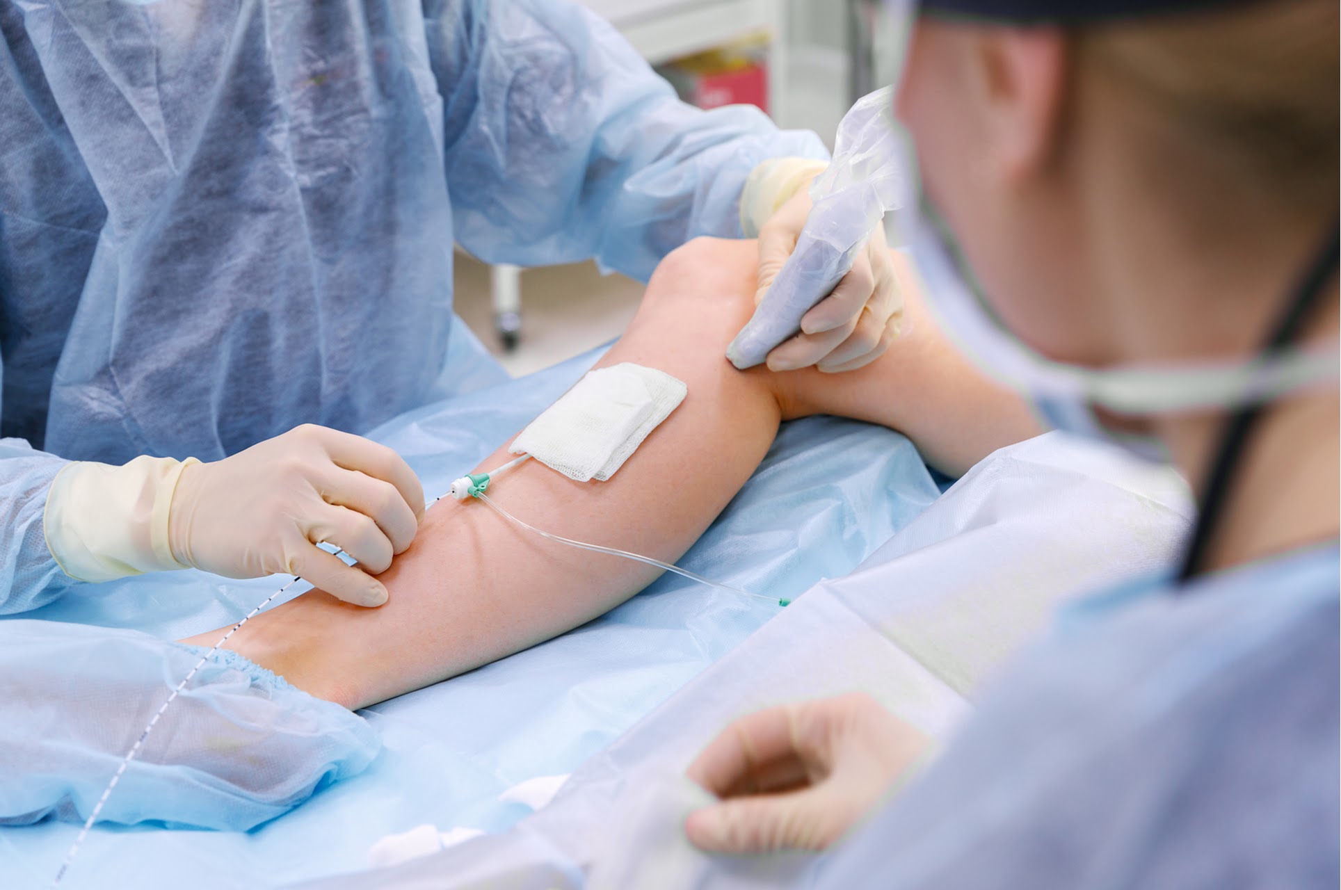 Varicose Vein Stripping