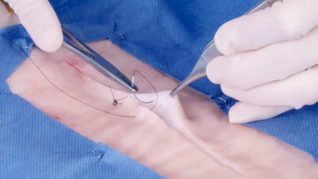 vicryl sutures3.jpg