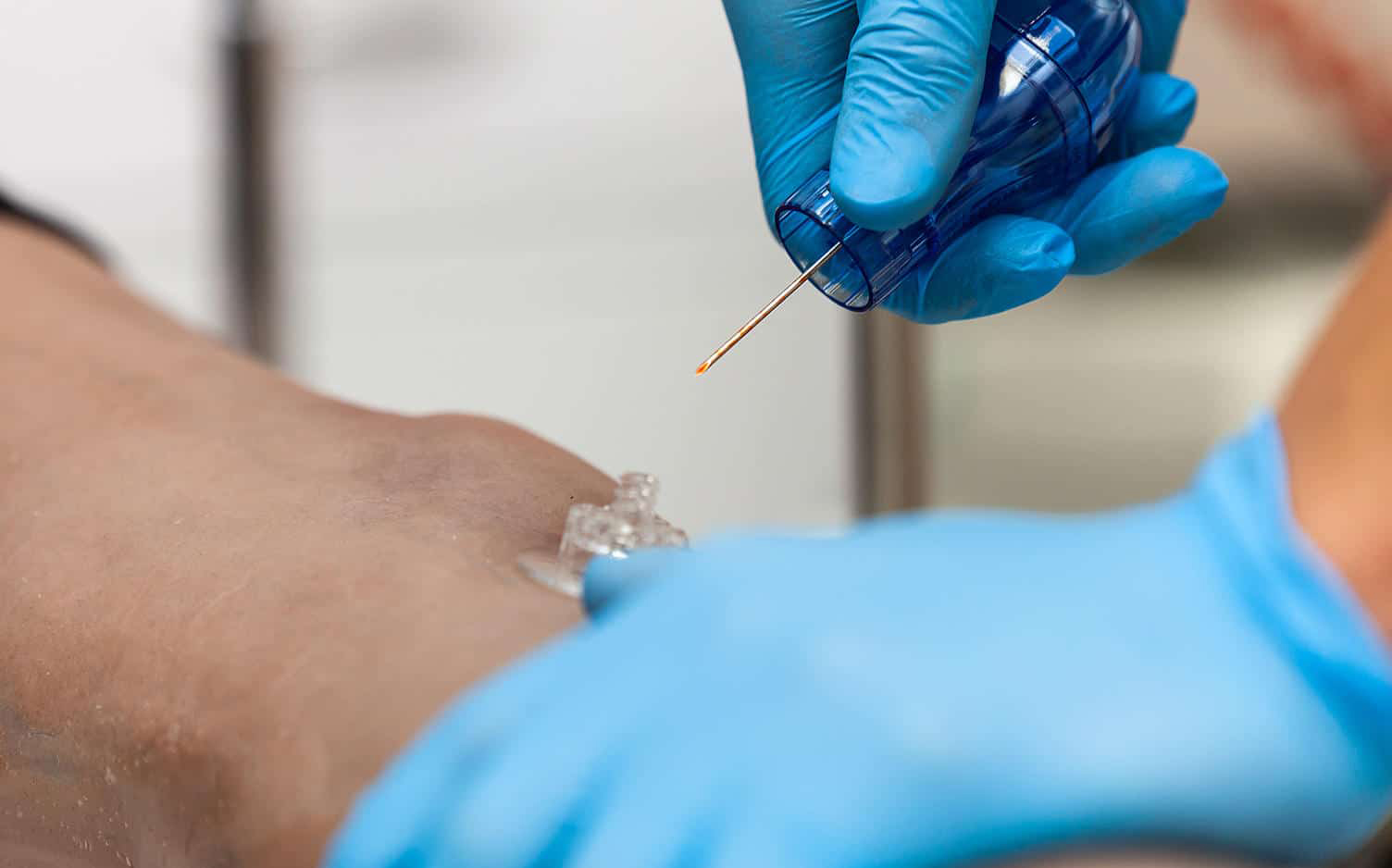 intraosseous infusion3.jpg